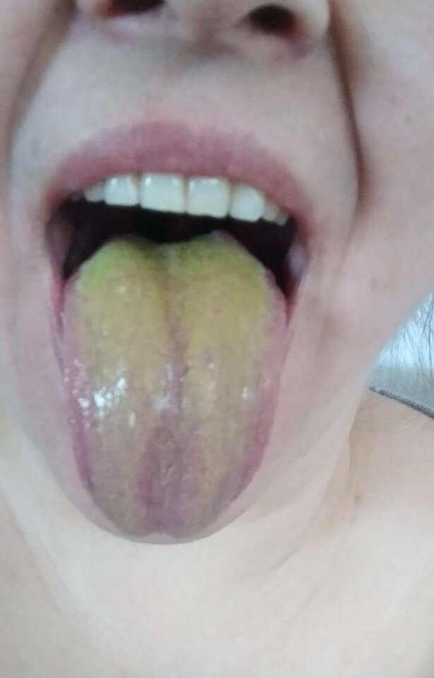 1000029556.jpg - Sukakurwi