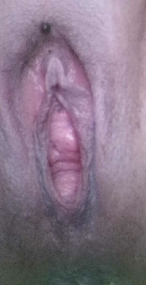 received_316832151058706.jpeg - NowiMy2