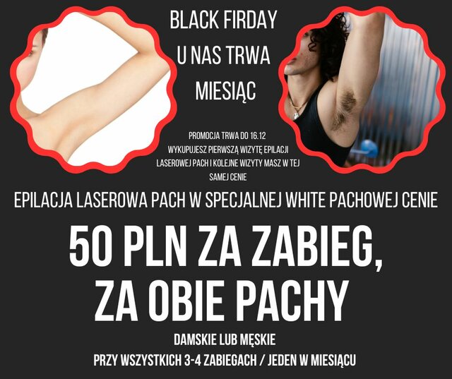 50 pln za obie pachy PapryczkaBeauty.jpg - SwingersBeautyWawa