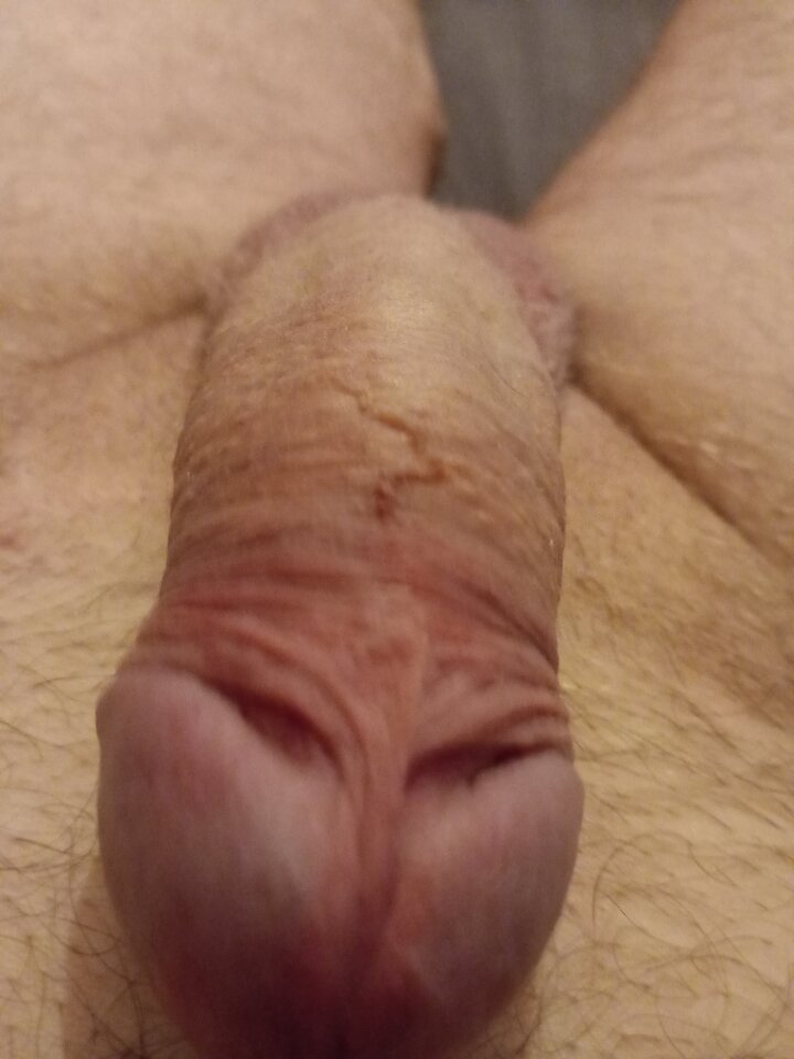 attach.jpeg - ParaKutasiSzpara