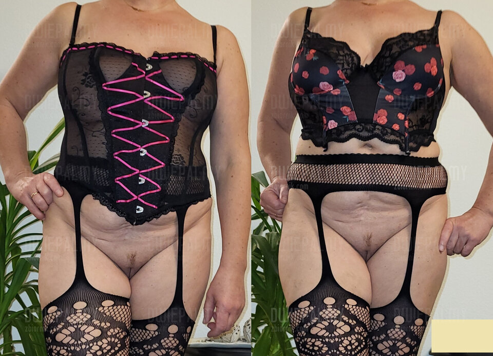 20231117_180741.jpg - dwiepalmy