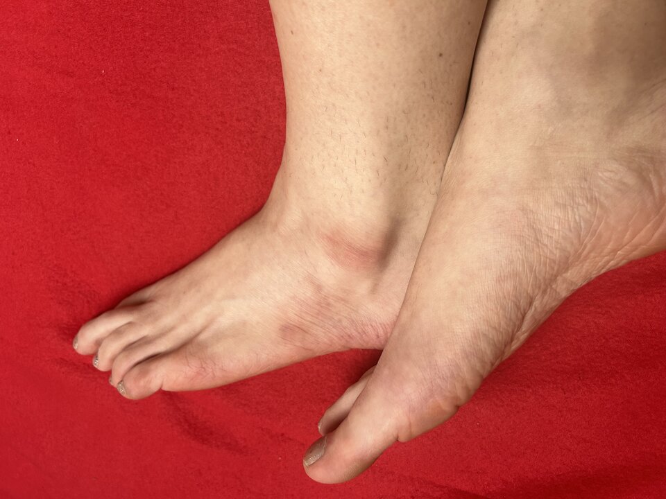 IMG_9325.jpeg - uleglakrysia