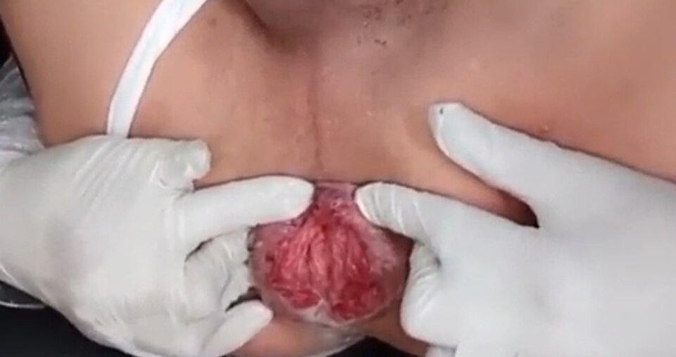 ODBYT 5.jpg - ArekNo1