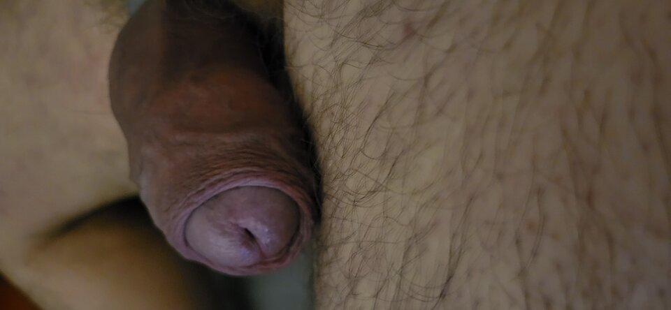 1000008904.jpg - HETEROTYLKOPANIE