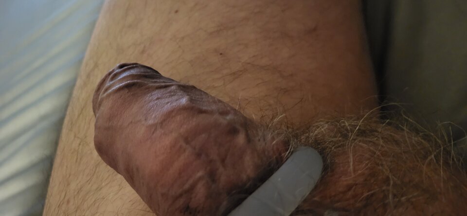 1000008903.jpg - HETEROTYLKOPANIE