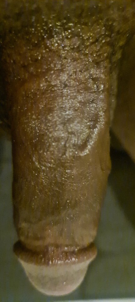 20241128_064227.jpg - Balthazar_1