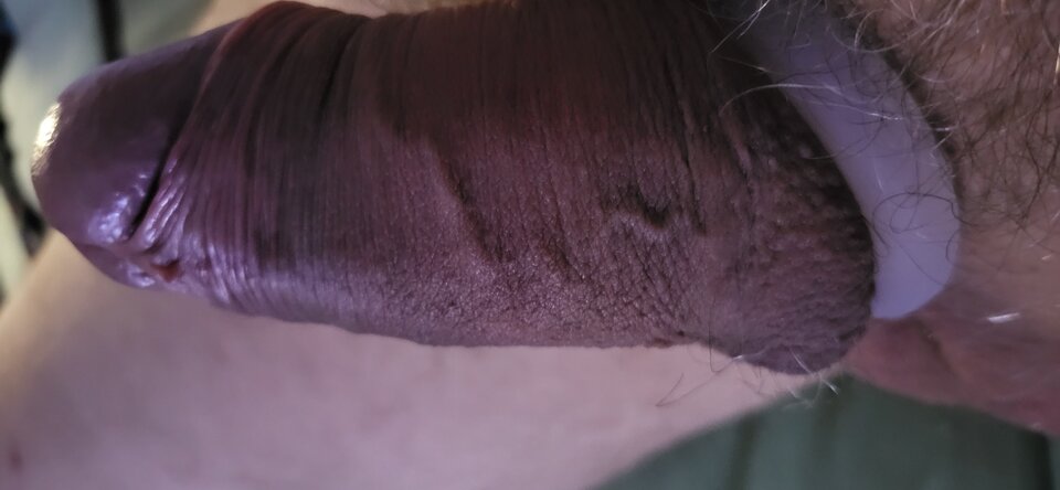 20241126_165555.jpg - HETEROTYLKOPANIE