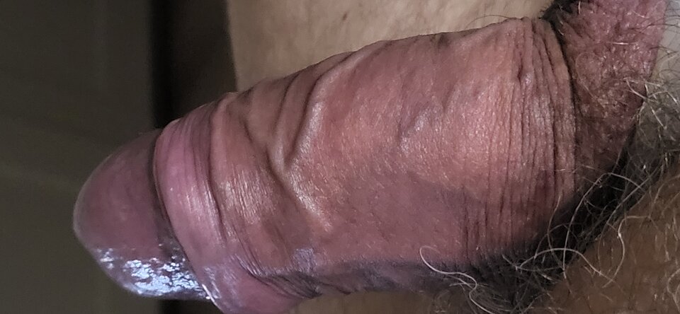 1000009708.jpg - HETEROTYLKOPANIE