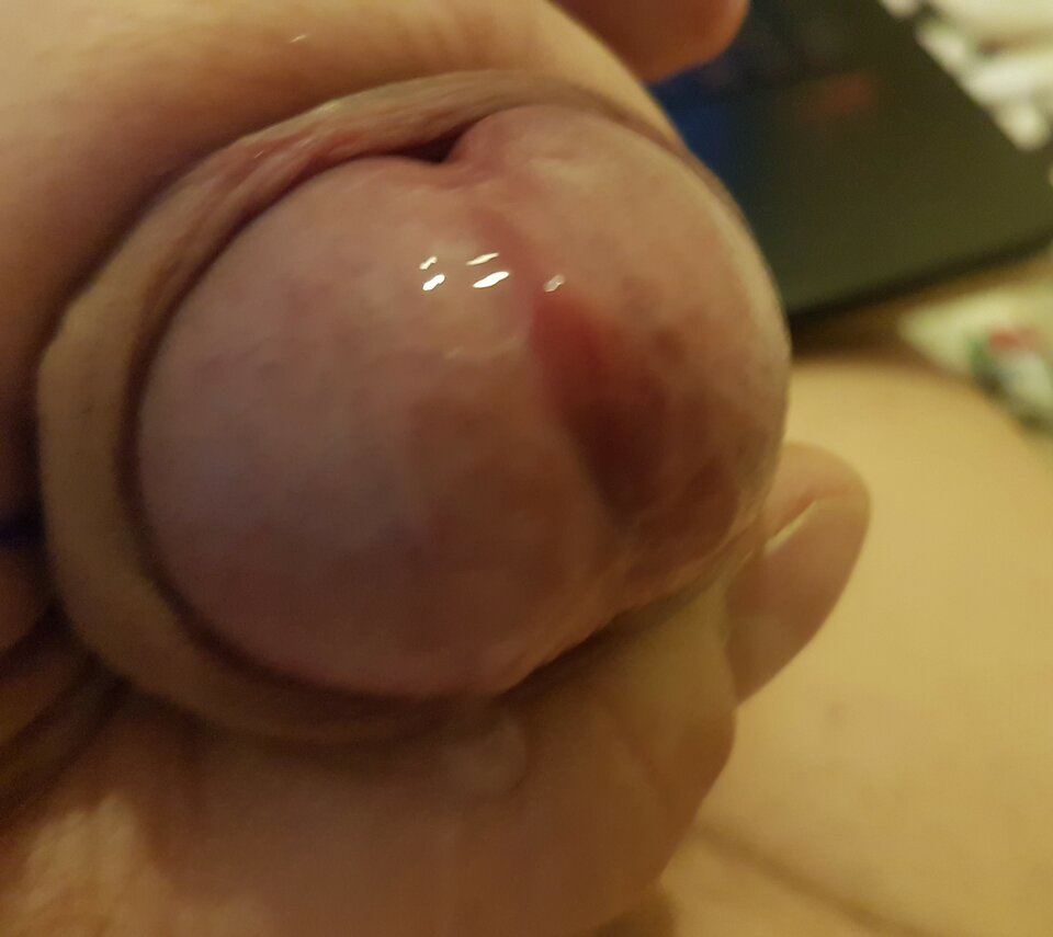 20170319_142443.jpg - bonet